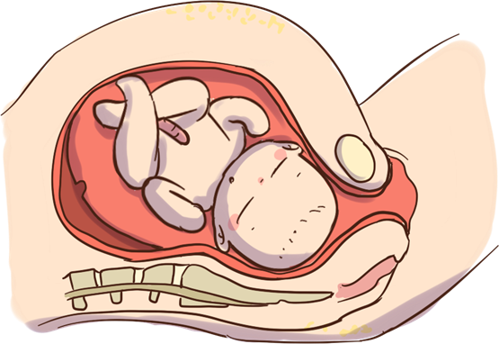 j9九游会观察 | 子宫脱垂是什么 麦特斯磁刺激仪助力女性盆底康复